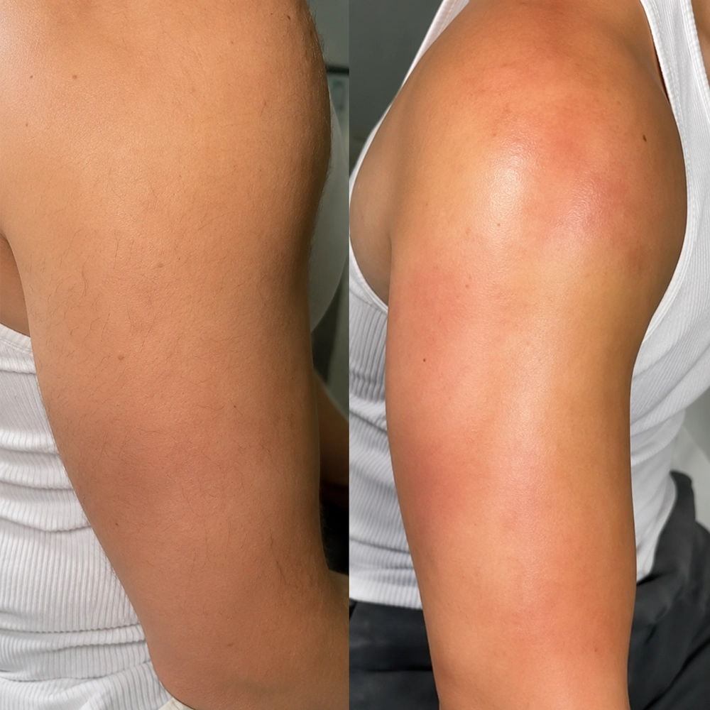 Visible results from a Beauty by Jingmei-ko waxing treatment